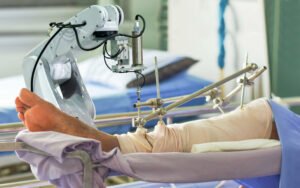 Read more about the article Top Robotic Knee Replacement Surgeon in Guntur 2026